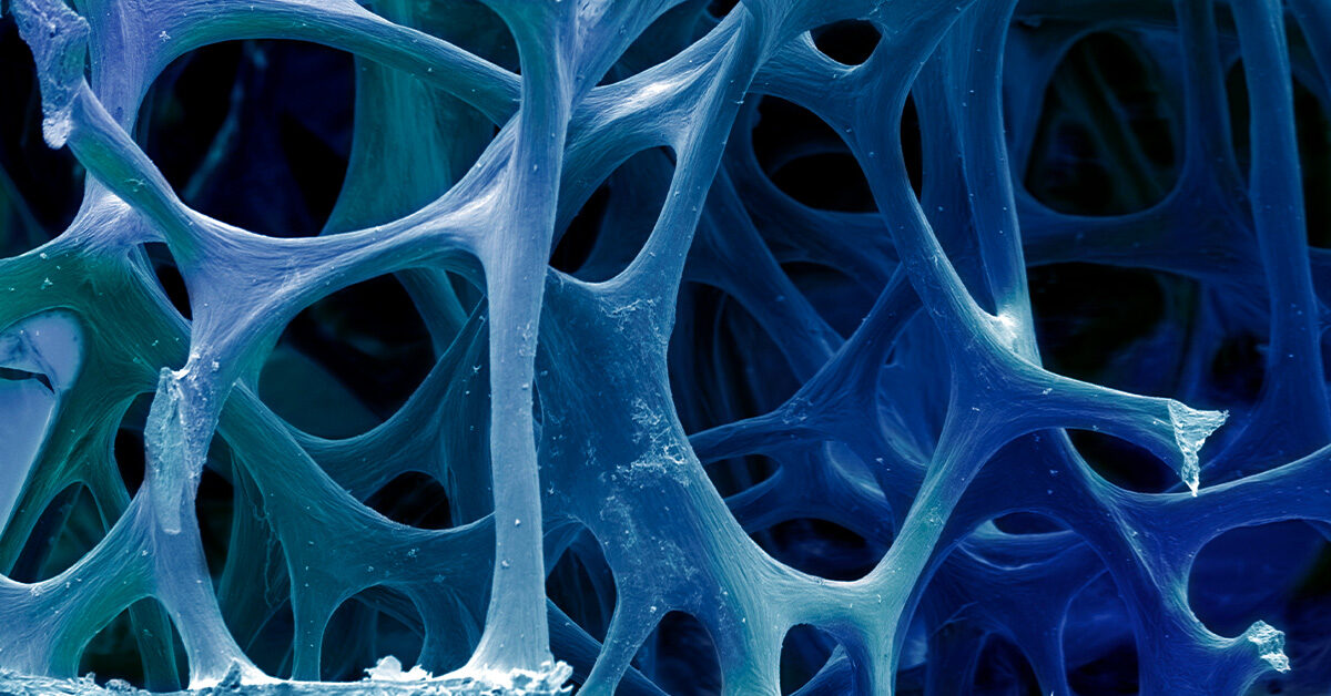 High blood pressure linked to bone loss and aging, mouse study finds